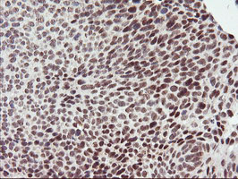 m18242 1 anti rnf113b mouse monoclonal antibody clone id oti2c10 ihc testing 6