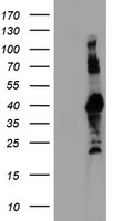 HEK293T cells were transfected with the pCMV6-ENTRY control (Left lane) or pCMV6-ENTRY RNF113B (Right lane) cDNA for 48 hrs and lysed