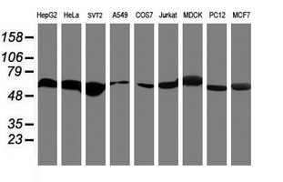 Western blot analysis of extracts (35ug) from 9 different cell lines by using anti-RNF113B monoclonal antibody