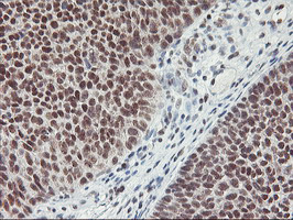m18242 anti rnf113b mouse monoclonal antibody clone id oti7a1 ihc testing 7
