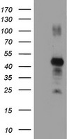 HEK293T cells were transfected with the pCMV6-ENTRY control (Left lane) or pCMV6-ENTRY RNF113B (Right lane) cDNA for 48 hrs and lysed