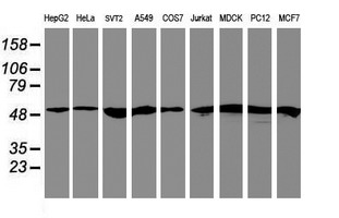 Western blot analysis of extracts (35ug) from 9 different cell lines by using anti-RNF113B monoclonal antibody