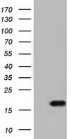 HEK293T cells were transfected with the pCMV6-ENTRY control (Left lane) or pCMV6-ENTRY TMEM80 (Right lane) cDNA for 48 hrs and lysed. Equivalent amounts of cell lysates (5 ug per lane) were separated by SDS-PAGE and immunoblotted with anti-TMEM80.