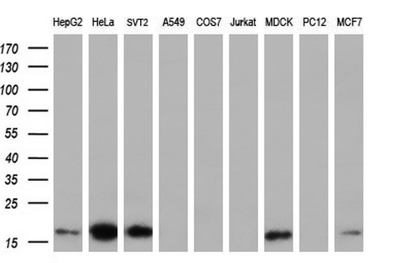 Western blot analysis of extracts (35ug) from 9 different cell lines by using anti-TMEM80 monoclonal antibody (HepG2: human; HeLa: human; SVT2: mouse; A549: human; COS7: monkey; Jurkat: human; MDCK: canine; PC12: rat; MCF7: human) (1:200).