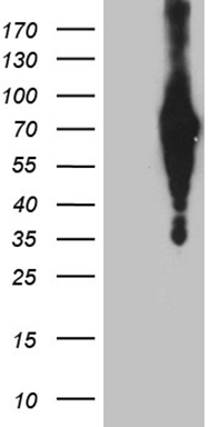 HEK293T cells were transfected with the pCMV6-ENTRY control (Left lane) or pCMV6-ENTRY C3orf25 (Right lane) cDNA for 48 hrs and lysed. Equivalent amounts of cell lysates (5 ug per lane) were separated by SDS-PAGE and immunoblotted with anti-C3or.