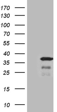 HEK293T cells were transfected with the pCMV6-ENTRY control (Left lane) or pCMV6-ENTRY THAP8 (Right lane) cDNA for 48 hrs and lysed. Equivalent amounts of cell lysates (5 ug per lane) were separated by SDS-PAGE and immunoblotted with anti-THAP8 (1:2000).