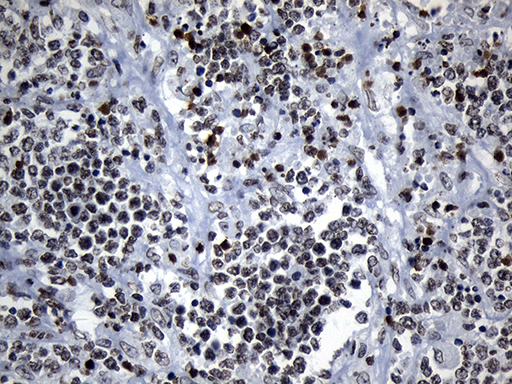m18589 anti znf705d mouse monoclonal antibody clone id oti1g1 ihc testing 10