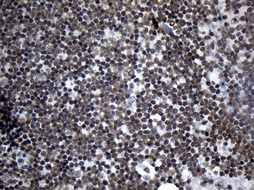 m18589 anti znf705d mouse monoclonal antibody clone id oti1g1 ihc testing 11