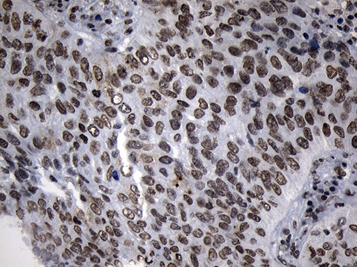 m18589 anti znf705d mouse monoclonal antibody clone id oti1g1 ihc testing 2