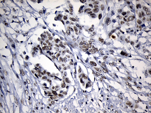 m18589 anti znf705d mouse monoclonal antibody clone id oti1g1 ihc testing 4