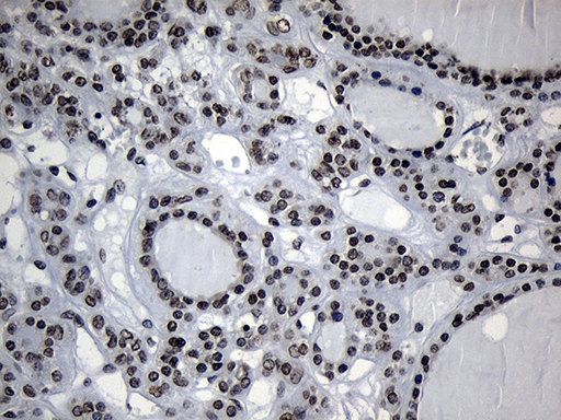 m18589 anti znf705d mouse monoclonal antibody clone id oti1g1 ihc testing 6