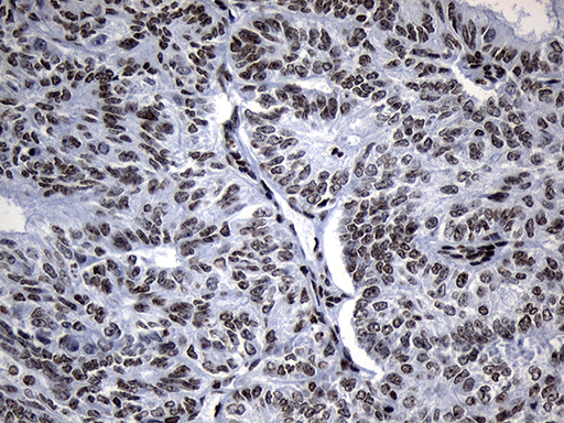 m18589 anti znf705d mouse monoclonal antibody clone id oti1g1 ihc testing 7