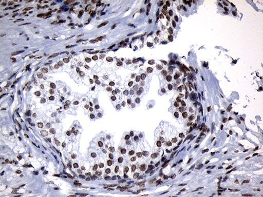 m18589 anti znf705d mouse monoclonal antibody clone id oti1g1 ihc testing 8