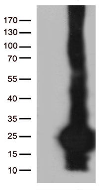 HEK293T cells were transfected with the pCMV6-ENTRY control (Left lane) or pCMV6-ENTRY C20orf79 (Right lane) cDNA for 48 hrs and lysed