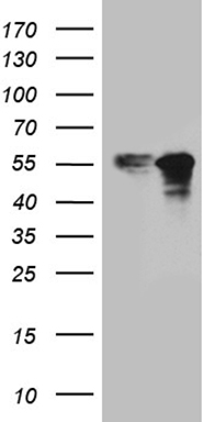 HEK293T cells were transfected with the pCMV6-ENTRY control (Left lane) or pCMV6-ENTRY ZNF718 (Right lane) cDNA for 48 hrs and lysed
