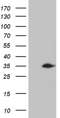 HEK293T cells were transfected with the pCMV6-ENTRY control (Left lane) or pCMV6-ENTRY C2orf80 (Right lane) cDNA for 48 hrs and lysed