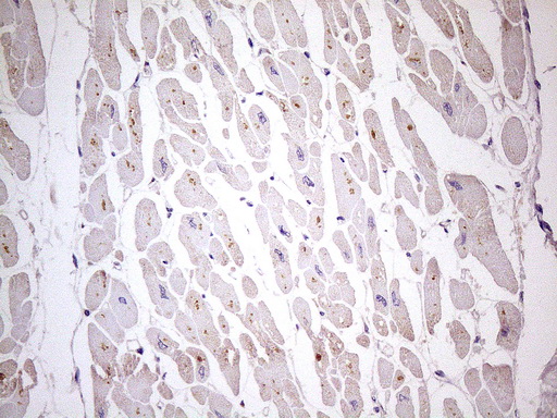 Immunohistochemical staining of paraffin-embedded Human adult heart tissue using anti-TBC1D28 mouse monoclonal antibody