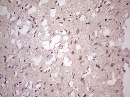 Immunohistochemical staining of paraffin-embedded Human adult brain tissue using anti-TBC1D28 mouse monoclonal antibody