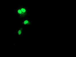 m20019 anti rad51l1 rad51b mouse monoclonal antibody clone id oti7h4 if testing 4