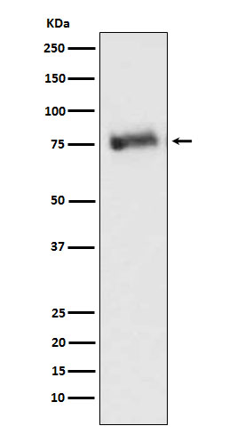 Western blot analysis of GRK3 expression in Ramos cell lysate