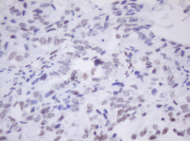 m30172 anti sen1 morf4 mouse monoclonal antibody clone id oti5f2 ihc testing 3