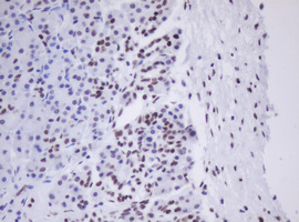 m30172 anti sen1 morf4 mouse monoclonal antibody clone id oti5f2 ihc testing 4