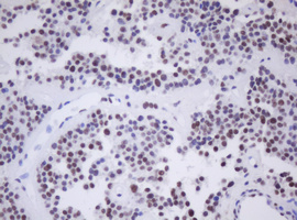 m30172 anti sen1 morf4 mouse monoclonal antibody clone id oti5f2 ihc testing 5
