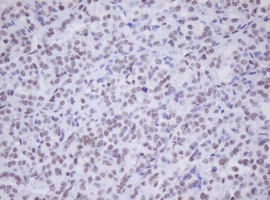 m30172 anti sen1 morf4 mouse monoclonal antibody clone id oti5f2 ihc testing 6
