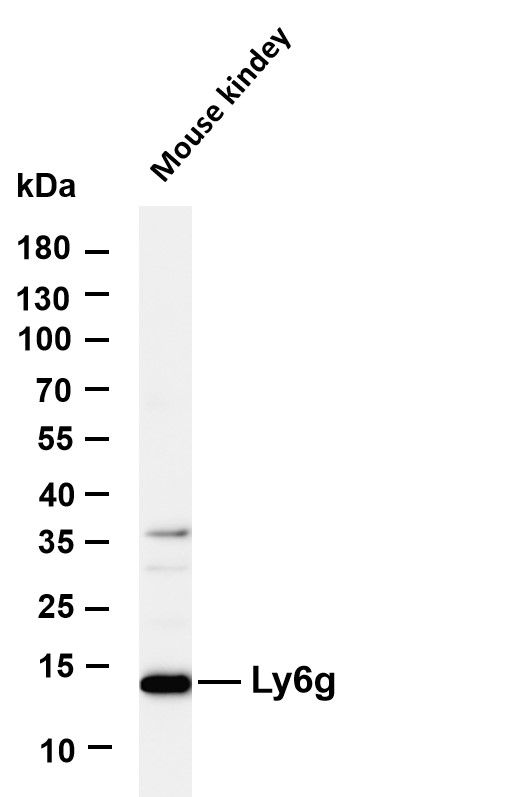 Various whole cell lysates were separated by 4-20% SDS-PAGE, and the membrane was blotted with anti-Ly6g antibody