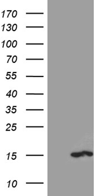 HEK293T cells were transfected with the pCMV6-ENTRY control (Left lane) or pCMV6-ENTRY PKIA (Right lane) cDNA for 48 hrs and lysed
