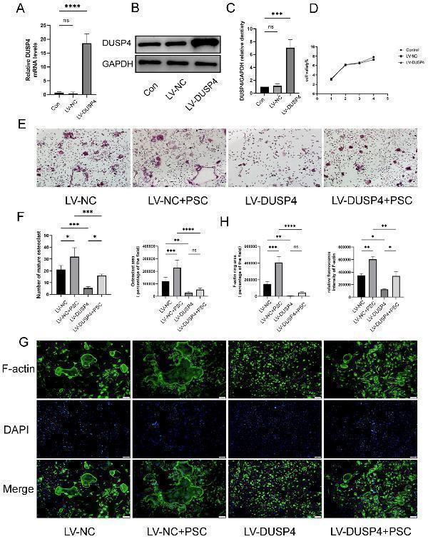 Overexpression of DUSP4 affects osteoclast formation