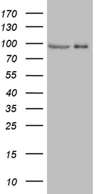 HEK293T cells were transfected with the pCMV6-ENTRY control (Left lane) or pCMV6-ENTRY PRKG2 (Right lane) cDNA for 48 hrs and lysed