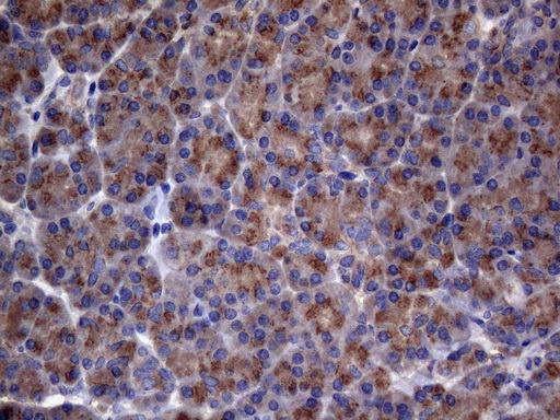 m30562 1 anti c11orf17 akip1 mouse monoclonal antibody clone id oti2e4 ihc testing 1