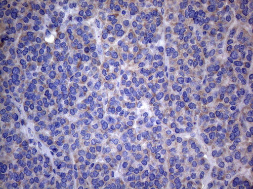m30562 1 anti c11orf17 akip1 mouse monoclonal antibody clone id oti2e4 ihc testing 2