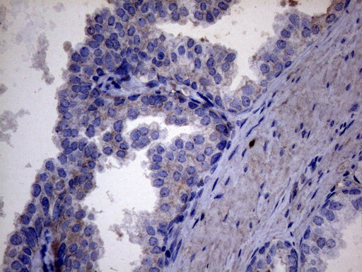 m30562 1 anti c11orf17 akip1 mouse monoclonal antibody clone id oti2e4 ihc testing 4