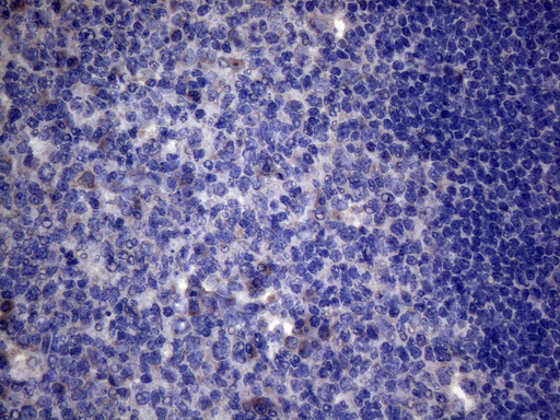 m30562 1 anti c11orf17 akip1 mouse monoclonal antibody clone id oti2e4 ihc testing 5