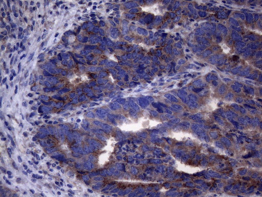m30562 1 anti c11orf17 akip1 mouse monoclonal antibody clone id oti2e4 ihc testing 6