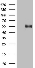HEK293T cells were transfected with the pCMV6-ENTRY control (Left lane) or pCMV6-ENTRY B4GALT3 (Right lane) cDNA for 48 hrs and lysed