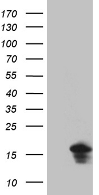 HEK293T cells were transfected with the pCMV6-ENTRY control (Left lane) or pCMV6-ENTRY EIF4E3 (Right lane) cDNA for 48 hrs and lysed