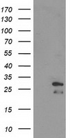 HEK293T cells were transfected with the pCMV6-ENTRY control (Left lane) or pCMV6-ENTRY ERAS (Right lane) cDNA for 48 hrs and lysed