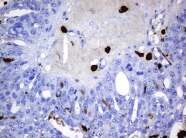m30724 anti hoxd10 mouse monoclonal antibody clone id oti1d11 ihc testing 2