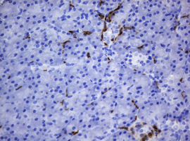 m30724 anti hoxd10 mouse monoclonal antibody clone id oti1d11 ihc testing 3