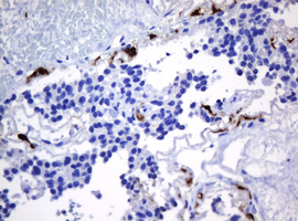 m30724 anti hoxd10 mouse monoclonal antibody clone id oti1d11 ihc testing 4