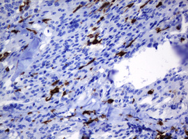 m30724 anti hoxd10 mouse monoclonal antibody clone id oti1d11 ihc testing 5
