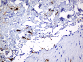 m30724 anti hoxd10 mouse monoclonal antibody clone id oti1d11 ihc testing 7