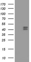 m30724 anti hoxd10 mouse monoclonal antibody clone id oti1d11 wb testing 1
