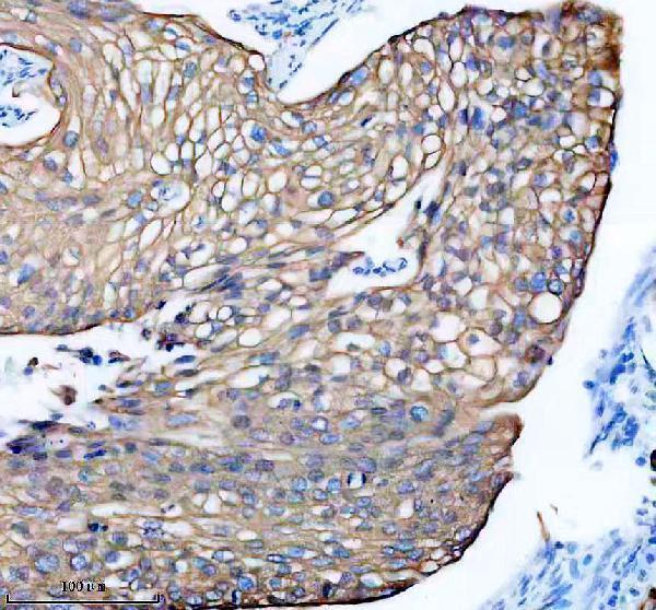 IHC analysis of Cytokeratin 6 using anti-Cytokeratin 6 antibody (M30943-1)