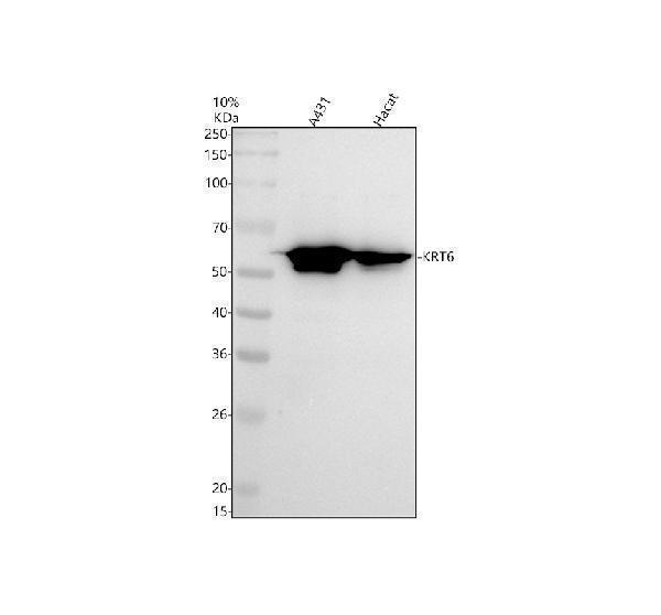 Western blot analysis of Cytokeratin 6 using anti-Cytokeratin 6 antibody (M30943-1)