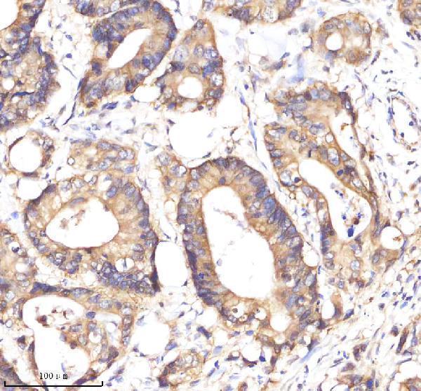 m30950 1 cd326 primary antibodies ihc testing 11