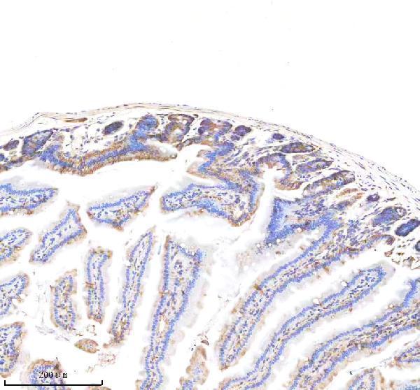  IHC analysis of EpCAM/Trop1 using anti-EpCAM/Trop1 antibody (M30950-1)